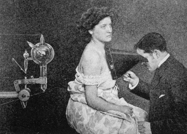 Durchleuchtung der Brust, Abbildung im New York Medical Journal vom 23. Februar 1907.